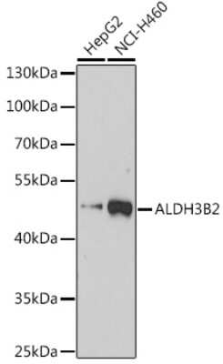 Western Blot ALDH3B2 Antibody - Azide and BSA Free